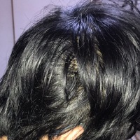 これってハゲですよね Agaは側頭部はそんなに影響ないって事らしいんですけ Yahoo 知恵袋