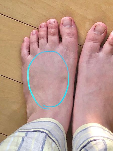 激痛 甲 に関するq A Yahoo 知恵袋