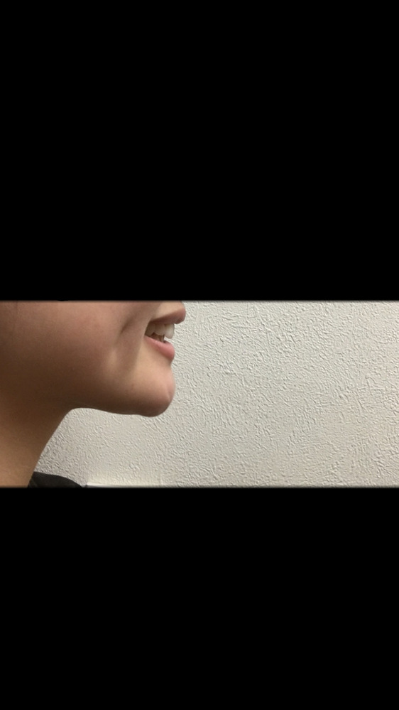 あご先の肉 筋肉 を落とすにはどうしたらいいですか ストレッチな Yahoo 知恵袋