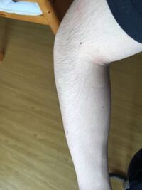 高3男子です 腕毛が長いです 友達からも長いと言われた事がありま Yahoo 知恵袋