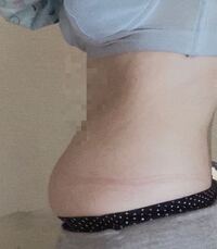 画像有 お腹ポッコリです 私は18歳の女です お腹以外 Yahoo 知恵袋