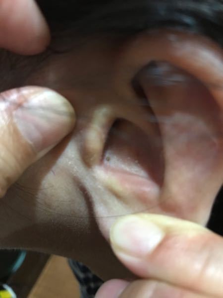 耳の病気 解決済みの質問 Yahoo 知恵袋