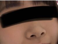 これって豚鼻ですか 低い潰れてる上向きの鼻がコンプレックスで Yahoo 知恵袋