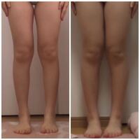 156センチです 何キロ痩せたように見えますか 右から左です Yahoo 知恵袋