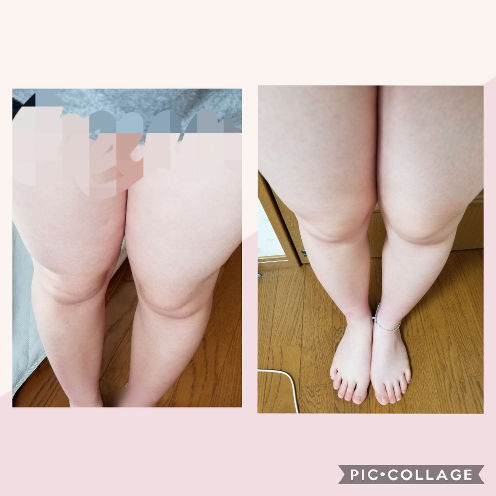 醜い写真をすみません 毎日 オガトレのふくらはぎやせ2セット 足パカ Yahoo 知恵袋