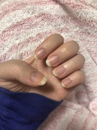 爪が青い 原因は 先日guで買ったスキニー まだ一度も洗濯して Yahoo 知恵袋