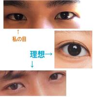 高須クリニックのモニターで二重全切開の整形を考えているのですが そこ Yahoo 知恵袋