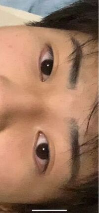 助けて下さい泣 目が左右非対称でほんとにキモいです こんな目を左右対称 Yahoo 知恵袋