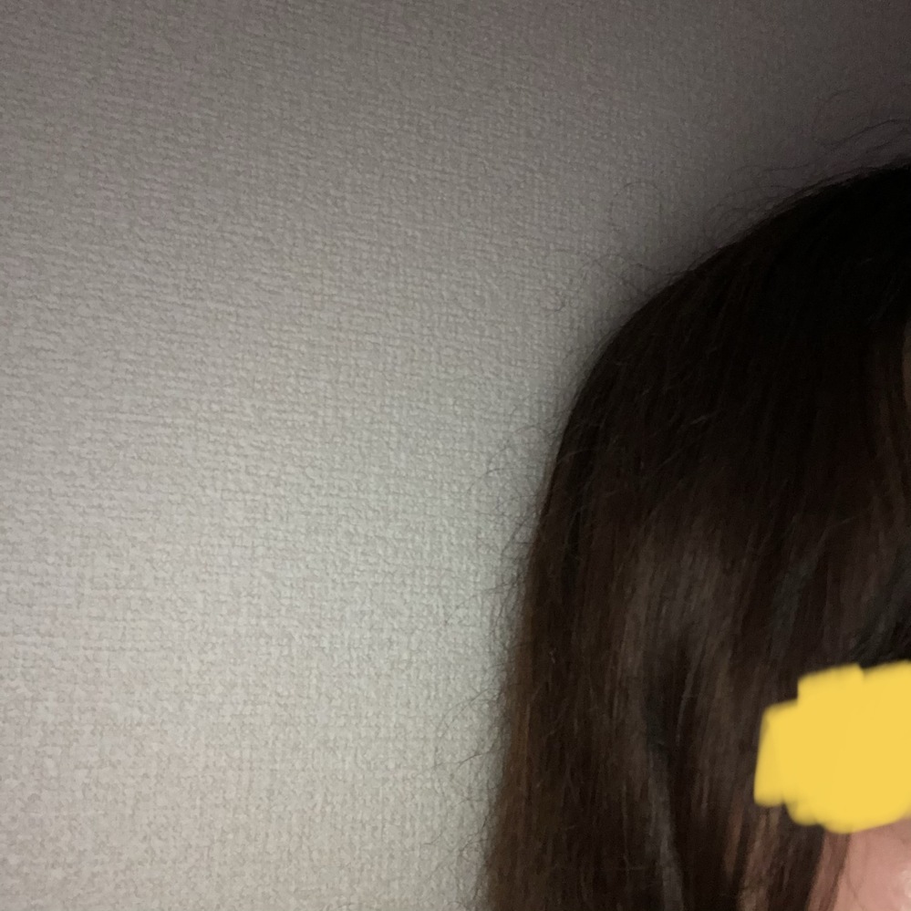 陰毛　薄い　中学生 髪の毛の表面（？）に陰毛のような毛がたくさんできてしまいます。中学生の頃は... - Yahoo!知恵袋