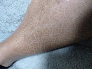 内なる 好奇心盛 染料 すね が カサカサ Toyoshin Biz