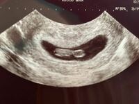 妊娠7週の妊婦です 今日検診に行ってきてエコー写真をもらったんですけ Yahoo 知恵袋