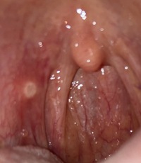 高校生女です 3日前ほど前から喉付近で違和感を感じ最初は風邪だと Yahoo 知恵袋