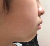 中学2年生の13歳です 私はこの写真の見ての通り顎の肉がひど Yahoo 知恵袋