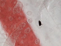 小さくて黒い虫が部屋の中に現れてジャンプしながら体に引っ付いて血 Yahoo 知恵袋