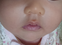 赤ちゃんの鼻について 生後2ヵ月です これはだんご鼻ですか 豚鼻 治り Yahoo 知恵袋
