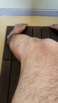 自分がalsなのか強直性筋ジストロフィーなのか分からずに居ます2 Yahoo 知恵袋