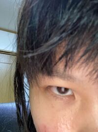 この重ったるいまぶたは美容整形の脂肪除去でなんとかなりますか Yahoo 知恵袋