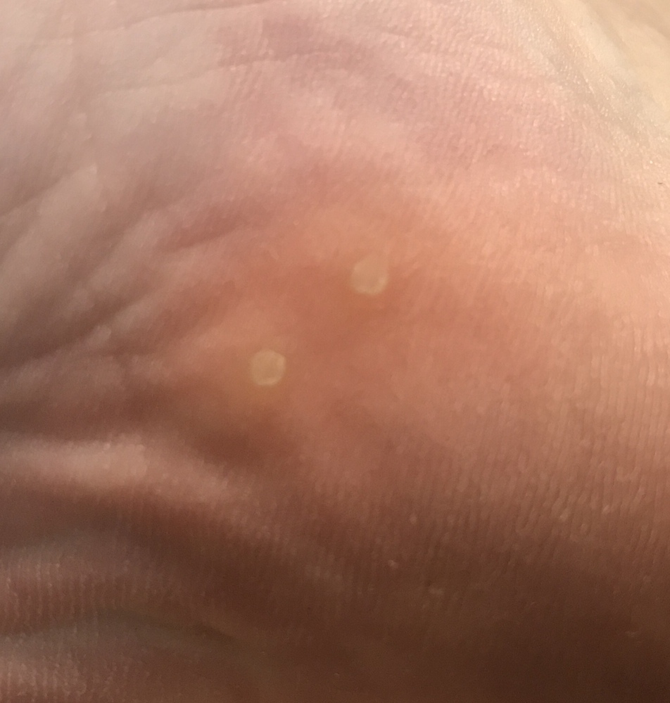 皮膚の病気 アトピー 解決済みの質問 Yahoo 知恵袋