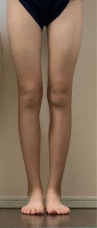 画像ありですお見苦しくてすみません 前ももの張りがひどくコンプレッ Yahoo 知恵袋