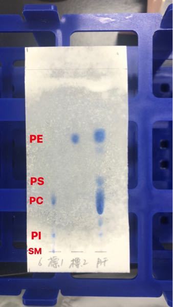 脂質の分析実験でリン脂質の薄層クロマトグラフィーを行ったのですが Yahoo 知恵袋