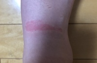 メディキュットについてです 毎日メディキュットをつけているのです Yahoo 知恵袋