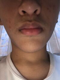 中学生男子です 下の写真のように顔が大きいです エラが張っている訳ではなく Yahoo 知恵袋