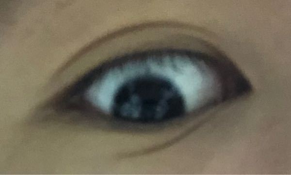 目頭まで二重の線が入らないのですがどうすればきれいな二重になれま Yahoo 知恵袋