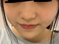 鼻筋がない団子鼻をどうにかしたいです 画像の通り 生まれつきこんな鼻です こ Yahoo 知恵袋