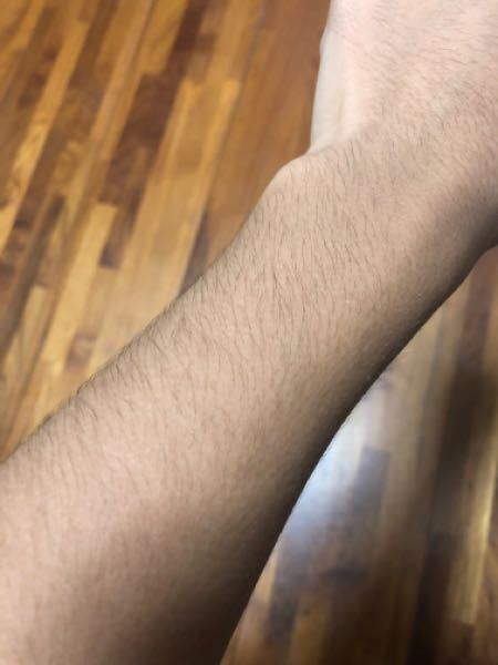 小学生　　腕毛 中学生です、この腕毛って濃い方ですか？ - 少し濃いと思いますが、剃れば全... - Yahoo!知恵袋