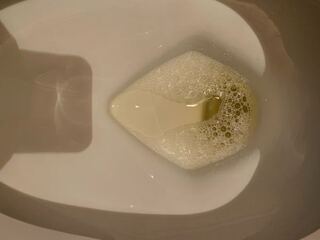 最近 尿が泡立ちます 画像を出しておくので詳しい方教えてください Yahoo 知恵袋