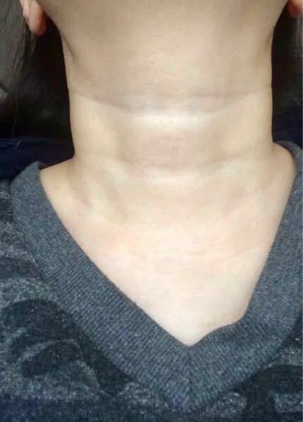 コスメ 美容 回答受付中の質問 Yahoo 知恵袋