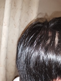 男子高校生です。
元から軟毛で毛量も少なかったのですが最近横の髪が透けてきました。
もうダメなのでしょうか？ 学校でも散々言われ、もう行きたくないです。
親に相談してみても大丈夫としか言われません