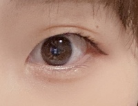 我が子の目の大きさ 我が家には3ヶ月の赤ちゃんがいます 検診で Yahoo 知恵袋