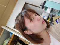 エラ張りひどいですか コンプレックスです Yahoo 知恵袋