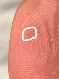 指に0 3のシャーペンの芯が刺さってしまいました 長さはよく分か Yahoo 知恵袋