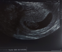 丁度9w 9週目 で検診に行きました 赤ちゃんの大きさは2 Yahoo 知恵袋