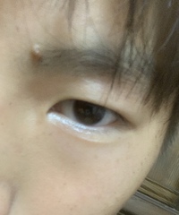 この目の下にある線って涙袋ですか Yahoo 知恵袋