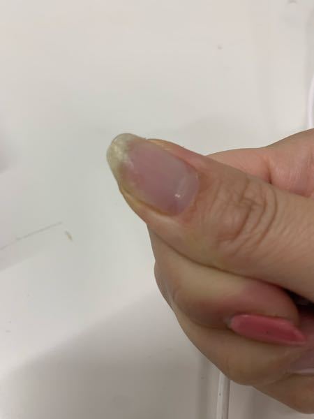 グリーンネイルになってますか Yahoo 知恵袋