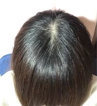 髪をオールバックで結ぶとおでこの生え際からアホ毛がたくさん出てきま Yahoo 知恵袋