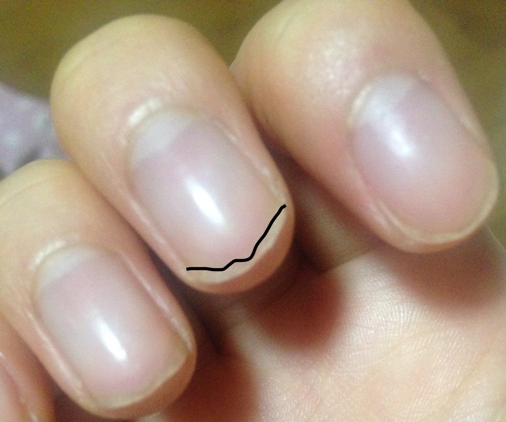 ネイルケア 解決済みの質問 Yahoo 知恵袋