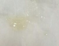 アレルギー性鼻炎ほっといたらどうなりますかそういう鼻水が出ます寝れば鼻づま Yahoo 知恵袋