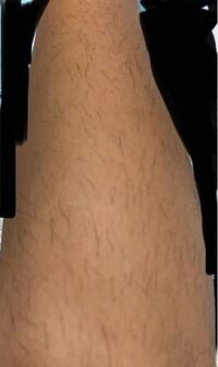 すね毛や腕の毛がツルツルの男って気持ち悪いですか 気持ち悪く Yahoo 知恵袋