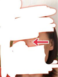 イライラ みやま市工藤内科 L ブログ