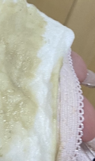 生理予定日の10日程前に出血して 結構量があったのでもう生理が始まったと思 Yahoo 知恵袋