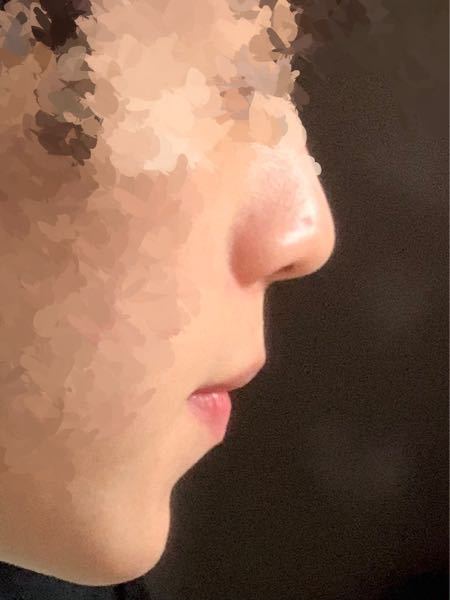 Eラインについて 僕は横顔が少しコンプレックスです 多分鼻が Yahoo 知恵袋