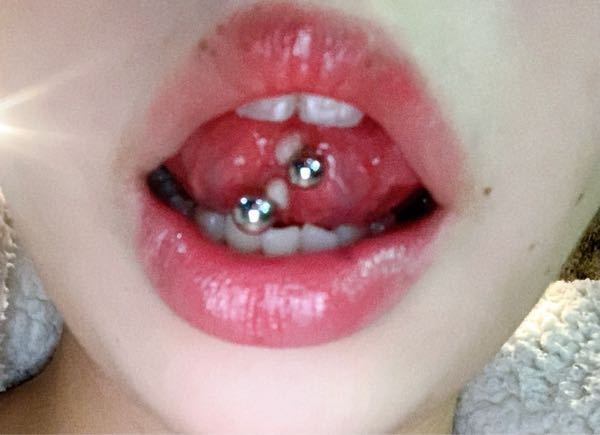 約1ヶ月前に舌ピを2連で開けたんですが、 - 舌の裏側のシャフト