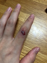 に を 包丁 切っ 行く 指 目安 病院 た で 指を切った！病院は何科？正しい応急処置方法と受診の目安
