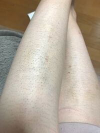 女ですが これスネ毛濃いほうですか 来月彼氏と温泉やスパに行くのです Yahoo 知恵袋