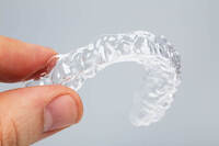 歯列矯正又はマウスピースリテーナー行ったことある方にお伺いします Yahoo 知恵袋