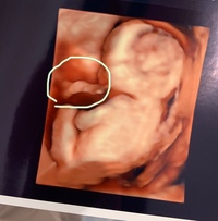 17週の初マタです 今月4日に健診に行ってふと思ったんで質問させてく Yahoo 知恵袋